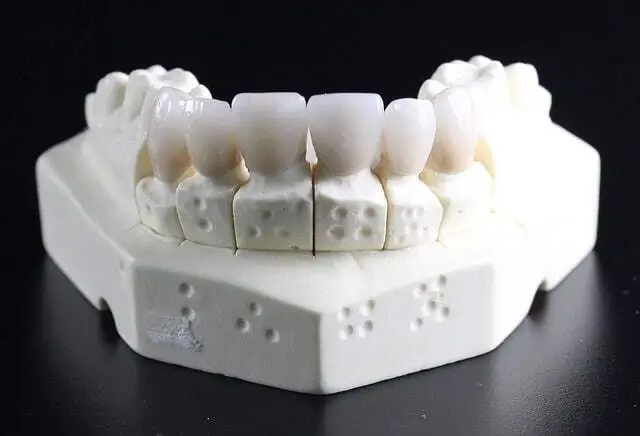 All about dental wax in its versatility