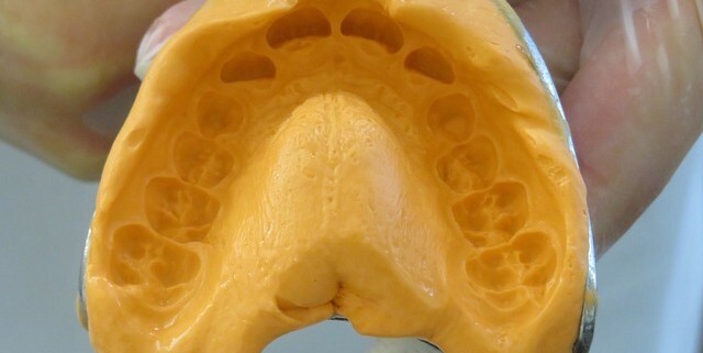 yellow dental putty impression material