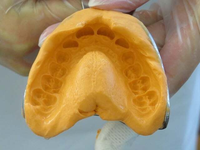Dental putty as dental impression material