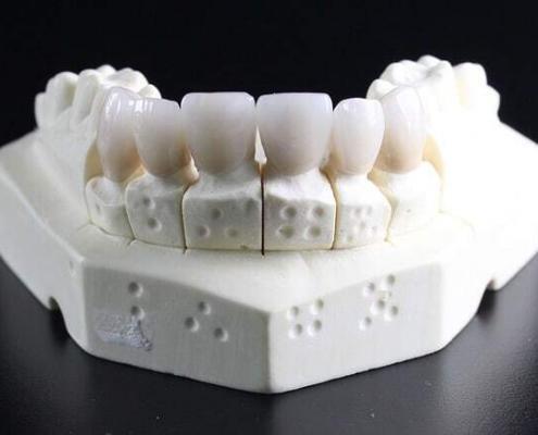 dental wax, modeling wax used for making reconstruction